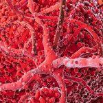 Ilustracja do artykułu: Mechanizmy zaburzeń krążenia i ich wpływ na organizm - obraz wyróżniający